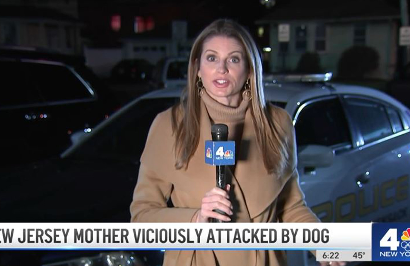 NJ mom hoping to keep fingers after dog attack